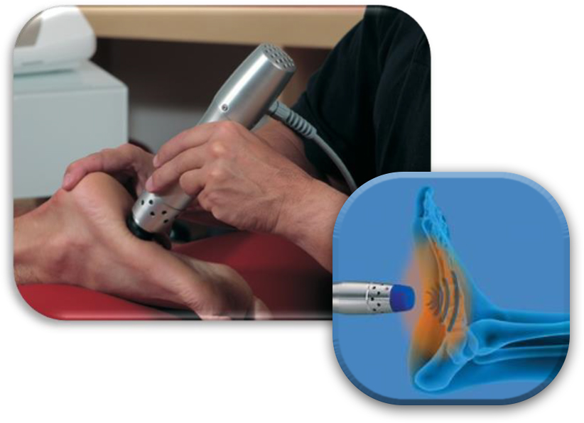 Radial Shockwave Therapy (RSWT)